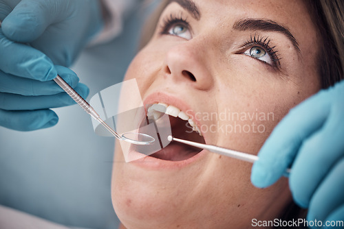 Image of Teeth, dental or woman at a dentist for surgery, teeth whitening or mouth cleaning for gum disease bacteria. Wellness, tooth decay or hands helping or working with oral tools in healthcare clinic