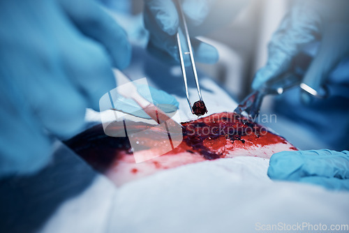 Image of Hands, blood and operation with a team of doctors at work during surgery with equipment or a tool in a hospital. Doctor, nurse and collaboration with a medicine professional group saving a life