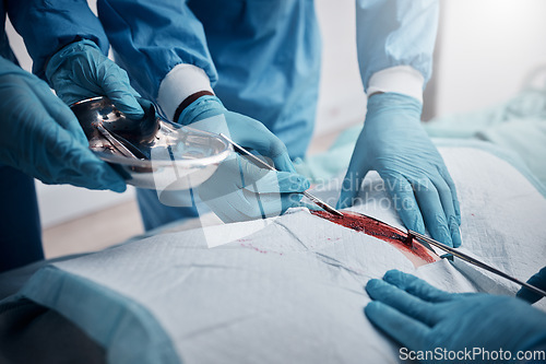 Image of Doctors, nurses or surgery hands on cut patient in hospital emergency room for stomach ulcer, heart attack or burst appendix. Zoom, healthcare workers or surgical operation and steel metal equipment