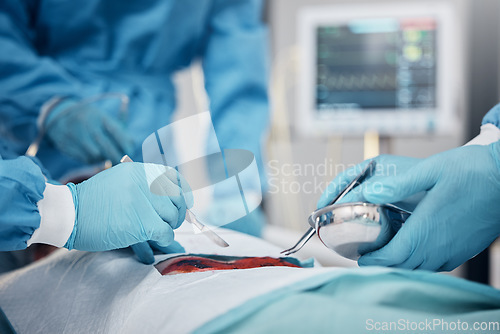 Image of Hands, blood and operation with a team of doctors at work during surgery with equipment or a tool in a hospital. Doctor, nurse and collaboration with a medicine professional group saving a life