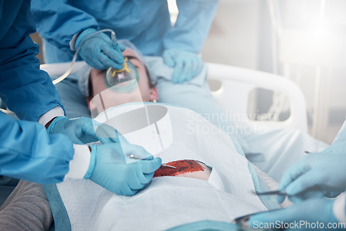 Image of Doctors, surgery and blood with a medicine team in scrubs operating on a man patient in a hospital. Doctor, nurse and teamwork with a medical group in a clinic to perform an operation