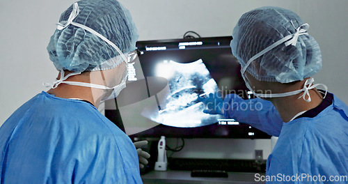 Image of Back, surgery, x ray and a team of doctors in the hospital for an operation or procedure to remove a tumor. Healthcare, medical planning and a surgeon looking at a screen with a medicine professional