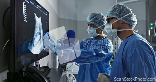 Image of Surgery, x ray and a team of doctors in the hospital for an operation or procedure to remove a tumor. Healthcare, medical teamwork and a surgeon looking at a screen with a medicine professional