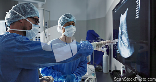 Image of Surgery, x ray and a team of doctors in the hospital for an operation or procedure to remove a tumor. Healthcare, medical teamwork and a surgeon looking at a screen with a medicine professional