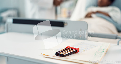 Image of Blood test, glass vial and documents in hospital for surgery, medical research and health for patient in bed. Doctor, medic and sick person in closeup for dna sample, folder or analysis for leukemia