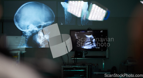 Image of Surgery room, xray and skull with healthcare, neuroscience and medicare with diagnosis. Holographic, medical treatment and skeleton with monitor, digital and brain with research, scan and anatomy