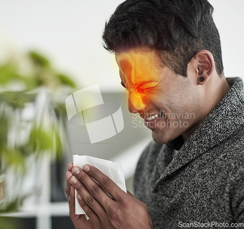 Image of Congestion, red pain and blowing nose with a man using a tissue in his home for relief from allergies. Sick, cold or flu and a young person ill with a virus due to pollen or hay fever symptoms