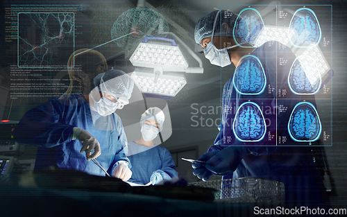 Image of Surgery, team and overlay neurology working research operation or hospital theater, confident or patient trust. Male person, hands and professional tools for brain anatomy, skull or medical doctors