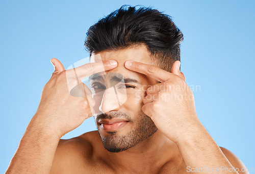 Image of Skincare, confused and portrait of acne man with hands on face feeling pimple with anxiety, doubt and stress. Model in studio analyzing skin with facial aesthetic problem on blue background.