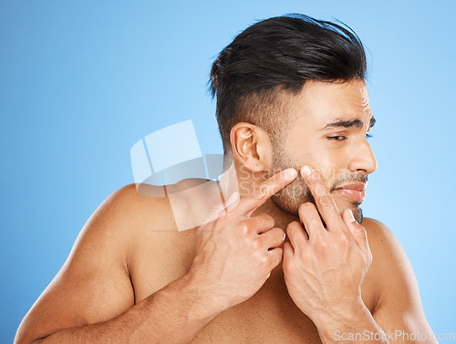 Image of Health, skincare and man popping acne in face with blue background. Mens skin care, morning facial and young guy with flaws, blemish and imperfection pop pimple or blackhead with fingers and hands.