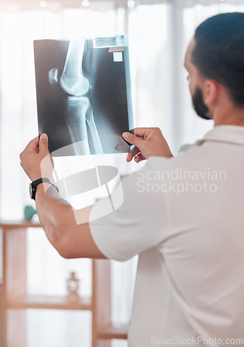 Image of Man, physiotherapist and x ray scan analysis in sports clinic for broken bone check, healthcare wellness or knee injury surgery planning. Medical worker, xray image or test results for physiotherapy