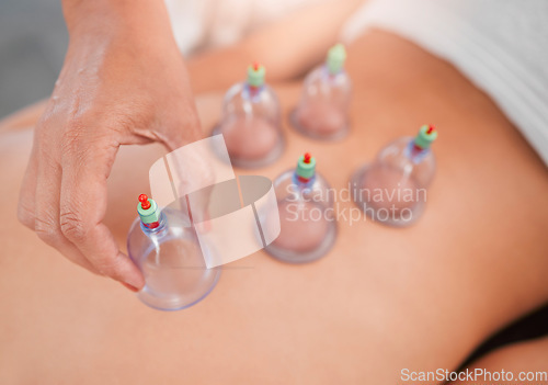 Image of Cupping, massage therapy for body care and health with wellness, luxury service at spa and alternative medicine. Massage therapist, hand and therapy for stress relief, vacuum banks and treatment.