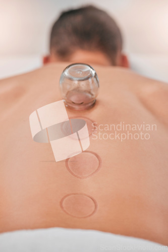 Image of Wellness, man and cupping massage at spa for relief in stress, inflammation and back pain, healthcare and relax. Cupping therapy, back and guy in resort for alternative therapy, acupuncture and rest