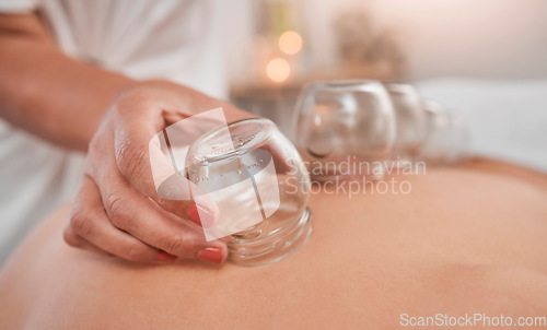 Image of Relax, health and cupping therapy with woman in spa for alternative medicine, healthcare and healing. Peace, skincare or luxury with patient and hands of massage therapist for beauty, zen or holistic