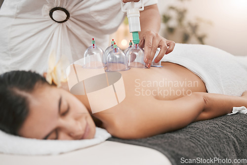 Image of Relax, health and cupping with woman in spa for alternative medicine, healing and physiotherapy. Peace, wellness and consulting with patient and hands of massage therapist for zen, holistic or muscle