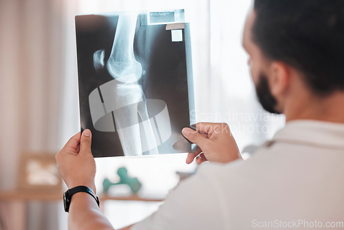 Image of Health, x ray and physiotherapy, man physiotherapist check medical results from injury, broken bone and healthcare. Physio, wellness and medicine, rehabilitation in health care and xray scan.