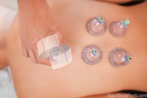 Image of Asian massage spa, cupping therapy and physiotherapy healing for body health, stress relief and back pain. Alternative medicine, physical therapy and zen meditation exercise for woman health wellness