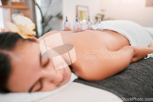 Image of Asian massage, cupping therapy and luxury spa for woman in physical therapy for back pain, wellness detox treatment and alternative medicine. Zen therapy exercise, organic wellness and stress relief