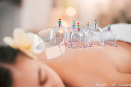 Image of Cupping therapy, spa and zen woman for chinese alternative medicine treatment for back pain and health. Bodycare and wellness with cup therapy for stress relief, wellbeing wiith cups and heat on skin