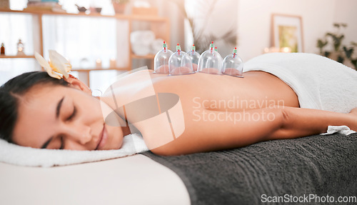 Image of Woman at spa for cupping and therapy, wellness and treatment body health and stress relief with alternative medicine. Massage therapy, relax and peace with vacuum banks on skin, body care and healthy