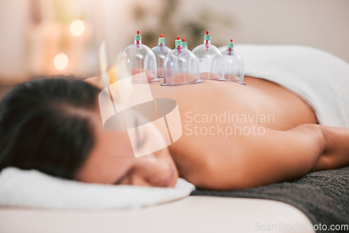 Image of Spa, physiotherapy or cupping therapy woman for massage, back pain or luxury wellness medical help. Asian medicine, health or relax girl for zen, spiritual or stress healing therapy with vacuum cups