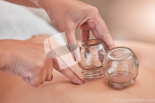 Image of Cupping, therapy and back massage at a wellness, health and beauty spa at a self care resort. Healing, body care and hands of a therapist doing healthy treatment with vacuum glasses for stress relief