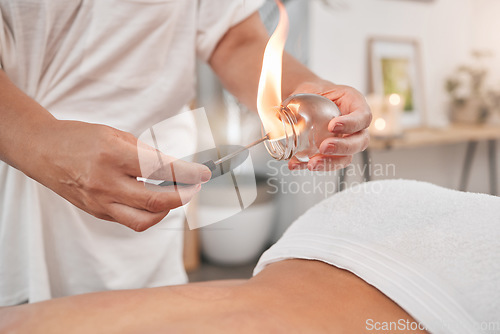 Image of Spa, cupping therapy and flame to relax, stress and tension release. Alternative medicine, wellness and suction cup for relief treatment, healing back pain and help with blood flow and inflammation.