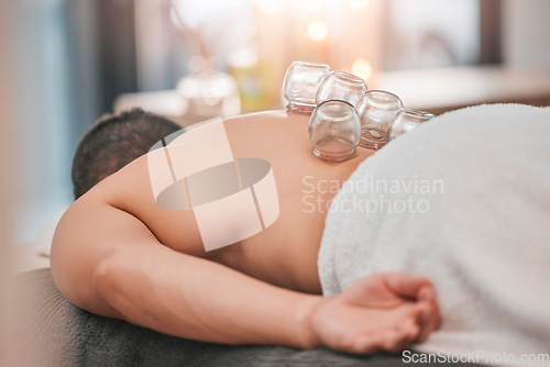 Image of Asian cupping therapy massage, man client and homeopathic healing for stress, back pain relief and spiritual wellness. Alternative treatment, physical therapy exercise and zen anatomy physiotherapy