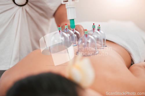 Image of Zoom, physiotherapy or woman with cupping therapy for back pain, physical therapy or relax wellness massage for meditation help.Medicine, medical or luxury health tech for zen in spa for support