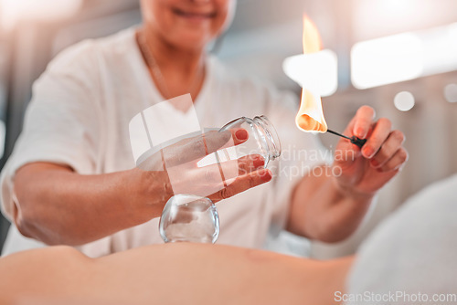 Image of Woman, hands or flame for cupping therapy in spa, hotel salon or holistic Chinese treatment for pain relief, muscle stress or injury. Zoom, massage therapist or fire in glass cup for wellness healing