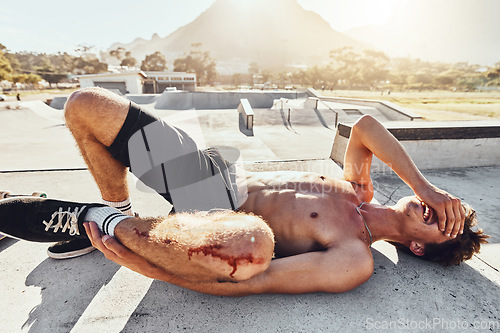 Image of Injury, blood and knee with a topless man crying in agony after a fall or accident to damage his body. Pain, skin and medical with a shirtless male suffering a gash to his joint in an emergency