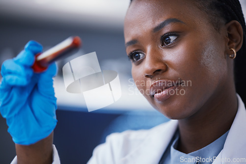 Image of Science, blood vial and female scientist in a lab working on a medical experiment, test or exam. Biotechnology, pharmaceutical and African woman researcher doing scientific research in a laboratory.