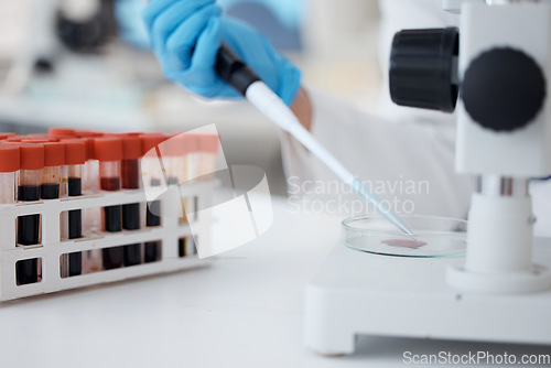 Image of Hands, pipette and scientist with blood petri dish for research in laboratory. Science, medical professional and doctor with dropper for dna analysis, test and biology experiment to study dna sample.