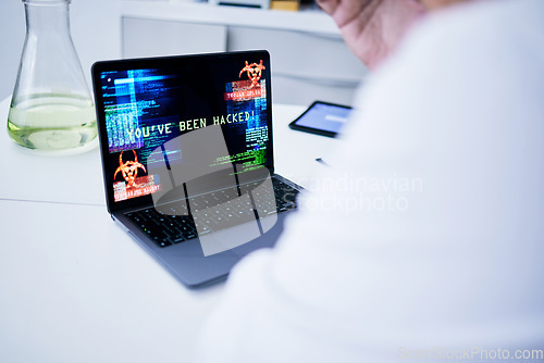 Image of Hacked, laptop or scientist with cyber security attack, virus problem or 404 glitch in laboratory. Screen, password mistake or medical worker with research trouble, software spam or ransomware danger