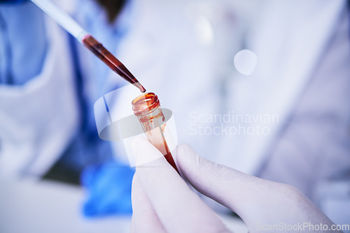 Image of Hands, pipette and scientist with blood test tube for research in laboratory. Science, medical professional and doctor with dropper for dna analysis, liquid and biology experiment to study dna sample