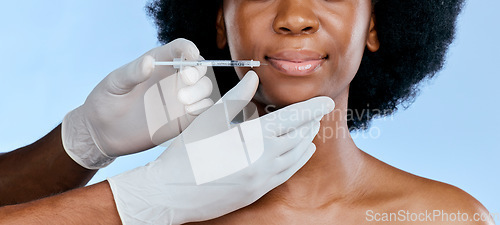 Image of Black woman, face injection and beauty with lip filler, cosmetic procedure and dermatology on blue background. Liquid collagen, mouth and skincare with hands, female model and smile in portrait