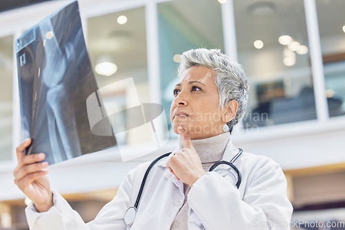 Image of Woman, radiology doctor and thinking with xray of test results, chart or healthcare analysis idea. Serious female surgeon planning ideas, medical solution and x ray report of bones, anatomy or injury