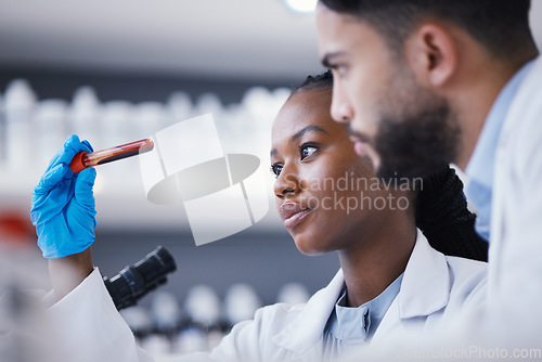 Image of Science, blood test and team of scientists in lab working on medical experiment, study or exam. Biotechnology, pharmaceutical and researchers in collaboration doing scientific research in laboratory.
