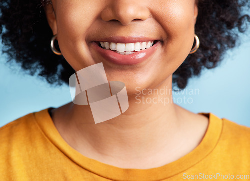 Image of Smile, woman and closeup of mouth and teeth for dental care, hygiene and whitening results. Happy, model and girl showing tooth for treatment progress isolated on a blue background in a studio