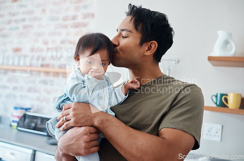 Image of Down syndrome baby bonding with father in their home, kiss and affection by caring parent for special needs infant. Love, family and children with asian parent embracing newborn with disability