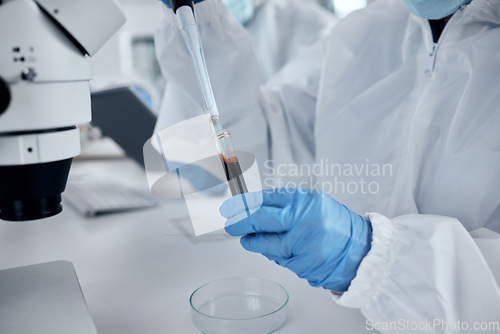 Image of Hands, scientist and blood pipette test tube for research, sample analysis or dna testing. Medical doctor, laboratory worker or chemist working with chemical dropper for health or disease diagnosis