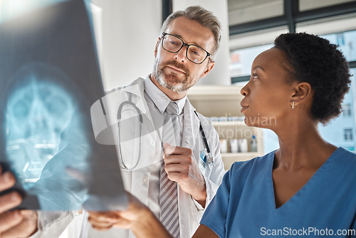 Image of Brain, x ray and neurology doctors in a meeting working on a skull injury in emergency room in a hospital. Diversity, cancer and healthcare medical neurologist checking mri or xray scan with teamwork