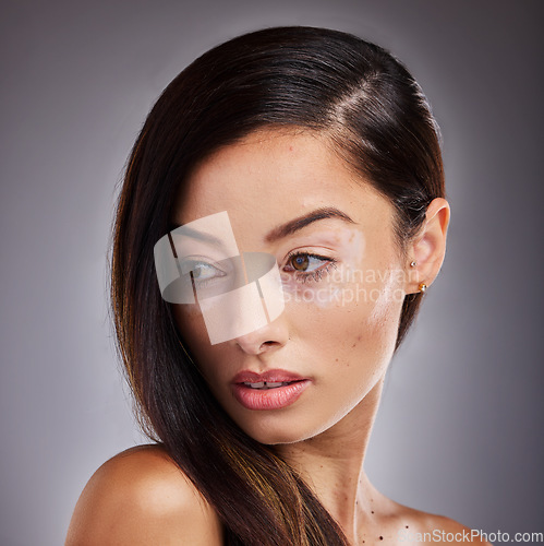 Image of Beauty, face and vitiligo with a model woman in studio on a gray background for natural hair care. Wellness, luxury and cosmetics with a young female posing for dermatology, wellness or pigmentation