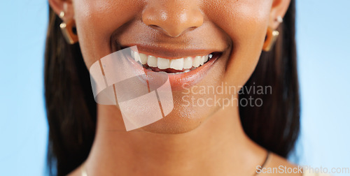 Image of Teeth whitening, closeup of dental and woman with smile for oral care, wellness and mouth on blue background. Beauty, hygiene and orthodontics with skin, cosmetics and healthy in studio with veneers