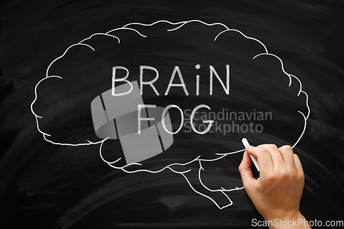 Image of Brain Fog Concept Drawn On Blackboard