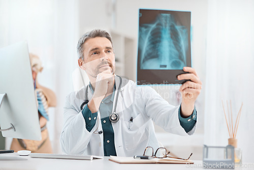 Image of What is the best way to stop this infection. a mature doctor analysing x-ray scans in a medical office.