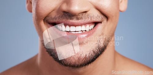 Image of He has the most perfect smile. Closeup shot of a young man smiling while posing against a studio background.
