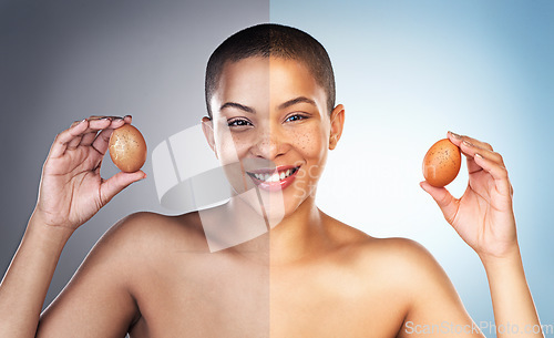 Image of I have something thatll restore your skin to a healthier state. Before and after concept of a young woman holding up two eggs.