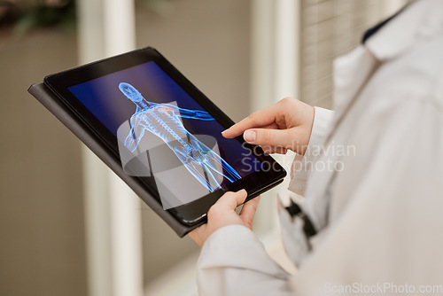 Image of Doctor, hands and tablet x ray, mri results and healthcare research, anatomy solution and injury review of skeleton. Medical professional or radiology person with xray graphic on digital screen