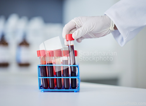 Image of Hand, doctor and blood in test tube, health and sample for experiment with medical research in lab. Scientist, person and healthcare, check for virus or bacteria with scientific study and pathology